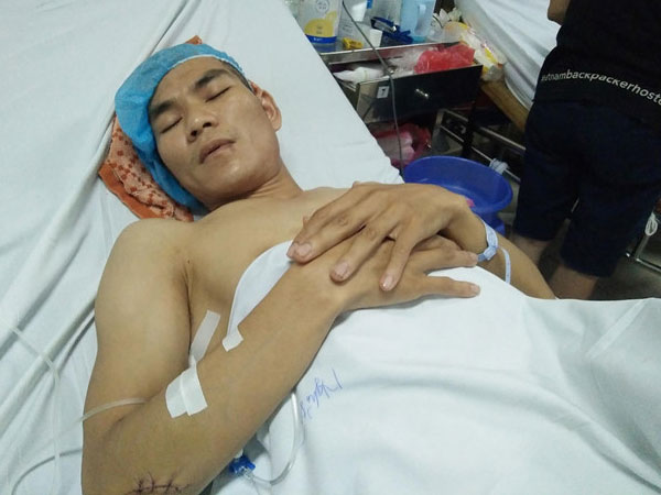 Nam ca sĩ bị chém 11 nhát dao vì tiểu bậy