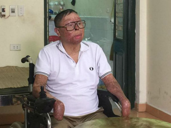 Chiến sĩ sống sót vụ rơi máy bay ở Hòa Lạc: "Có người nhận tài trợ lắp tay giả cho tôi"