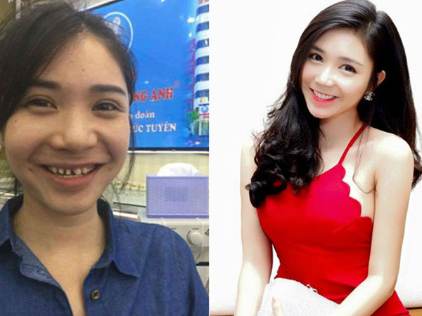 Thanh Bi: "Hình ảnh trên mạng xã hội đã bị sửa xấu đi"