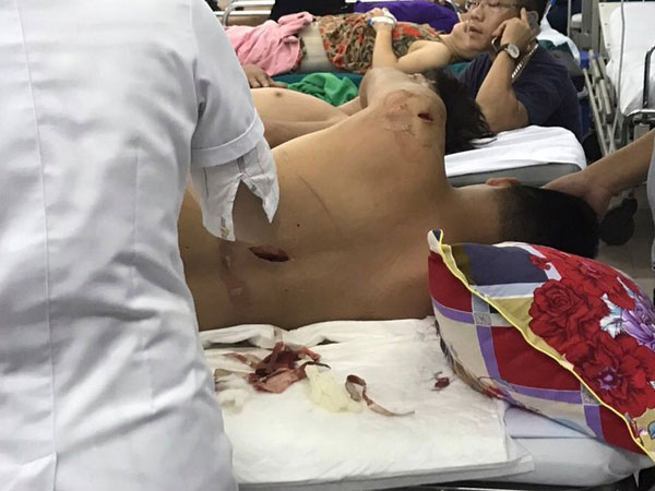 Nam thanh niên gục ngã trước lưỡi kiếm truy sát của nhóm côn đồ bịt mặt