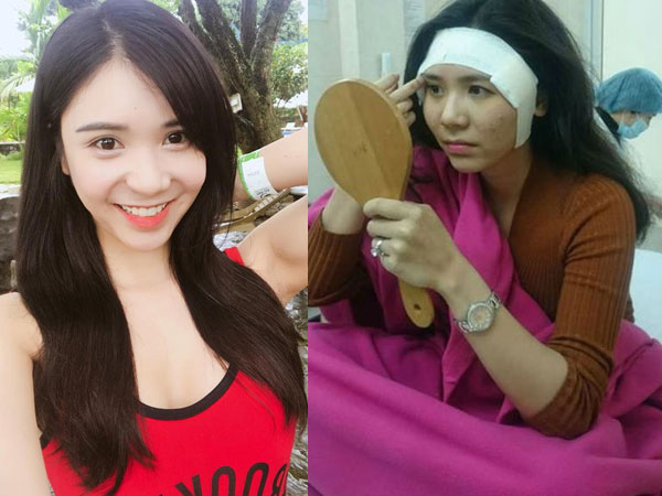Thực hư chuyện Thanh Bi "đập đi xây lại" toàn bộ cơ thể gây sốc
