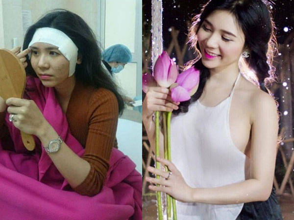 Thanh Bi lên tiếng về loạt ảnh phẫu thuật thẩm mỹ cận cảnh