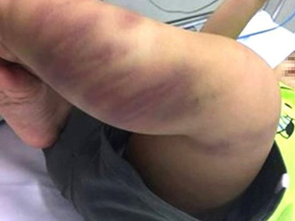 Bà ngoại bé trai 1 tuổi bị bạo hành: Sao họ độc ác thế?