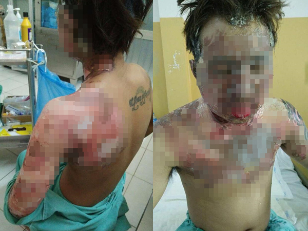 Giận vợ, chồng tưới xăng dọa đốt nhà, lửa bùng cháy gây bỏng cho cả đứa con mới hơn 2 tuổi