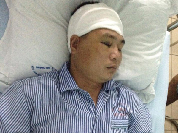 Hải Phòng: Hé lộ nguyên nhân nhóm côn đồ truy sát người dân trọng thương