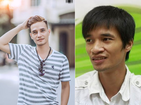 Hậu phẫu thuật thẩm mỹ, Lệ Rơi khoe bộ ảnh mới đẹp trai như Tây: Đời tôi thay đổi từ đây
