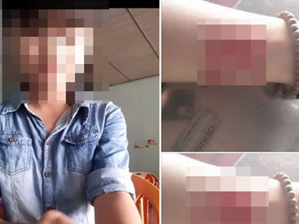 Hội chứng ngược đãi... bản thân