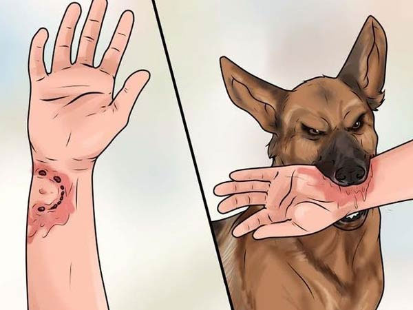 Cách xử lý khi bị chó cắn