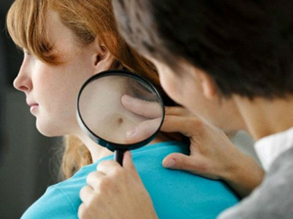 15 dấu hiệu cảnh báo ung thư