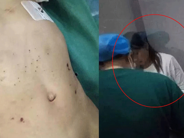 Bé gái 3 tuổi bị bỏng da đầu, kim đâm chi chít ở bụng từ những lần tra tấn dã man của mẹ kế