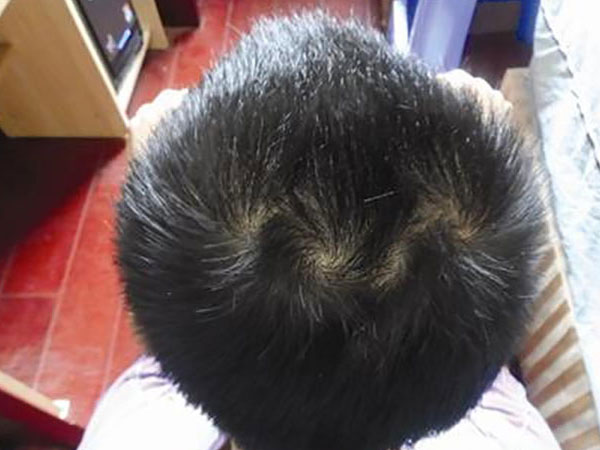Vạch tóc xem xoáy, biết ngay tính cách, số phận CHÌM NỔI