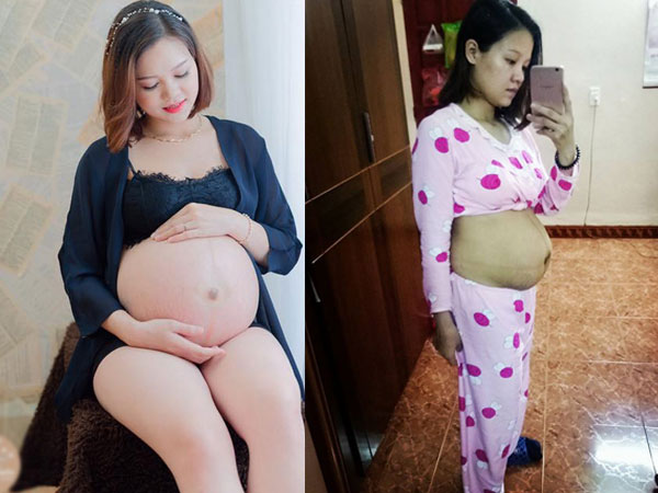 Vòng eo 10 ngày sau sinh “như chưa đẻ" của mẹ 9x khiến hội chị em còn son giật mình