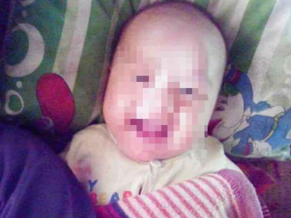 Hà Giang: Cháu bé 2 tháng tuổi tử vong vì sặc sữa ở bệnh viện?