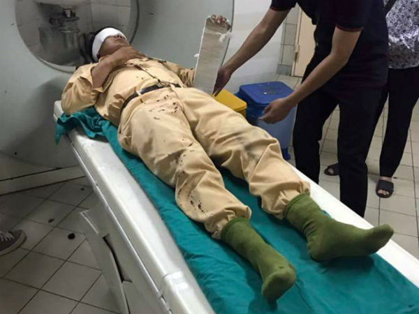 Hà Nội: Vi phạm giao thông, người điều khiển xe máy đâm CSGT gãy tay rồi bỏ đi