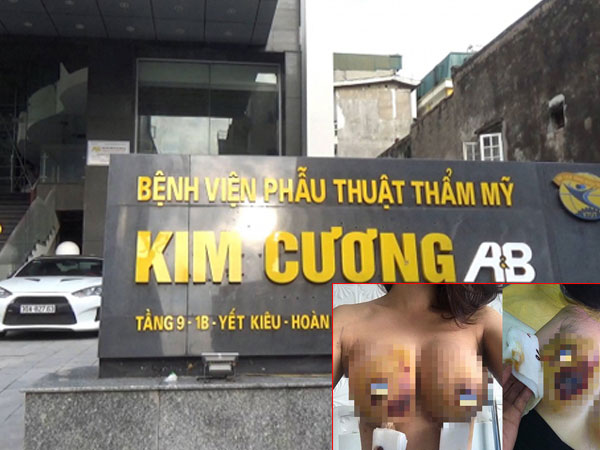 Chi 13.000 USD nâng ngực: BV Kim Cương khẳng định không có biến chứng
