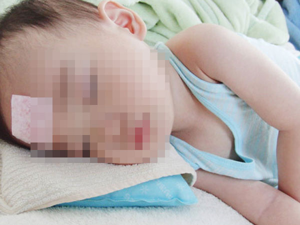 Bé gái 4 tuổi suýt chết sau cơn nhức đầu đột ngột