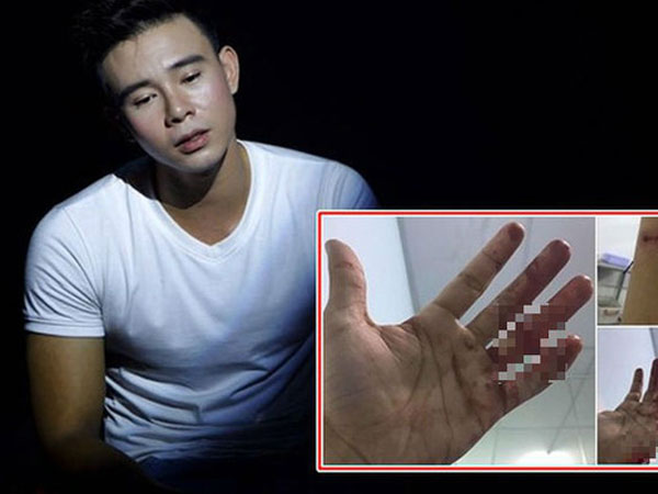 Đông Hùng nhắn tin với ca sĩ Pha Lê sau khi bị chủ nợ chém