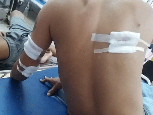 Thanh Hóa: 3 thanh niên bị nhóm người bịt mặt bắn trọng thương
