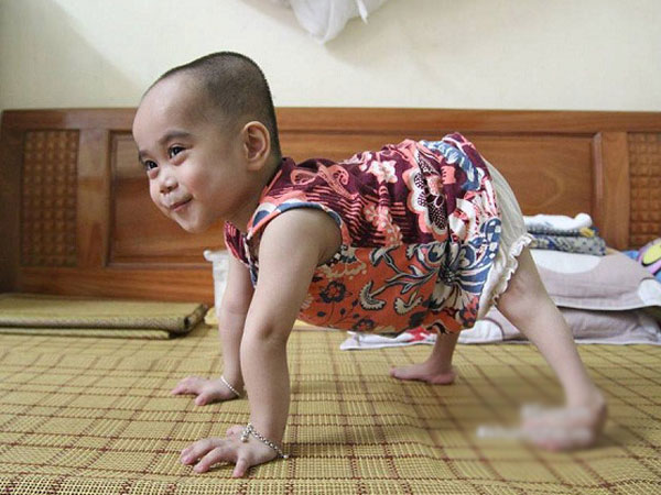 Em bé đi bằng “4 chân”, sống nhờ vào những chiếc bao cao su và băng vệ sinh