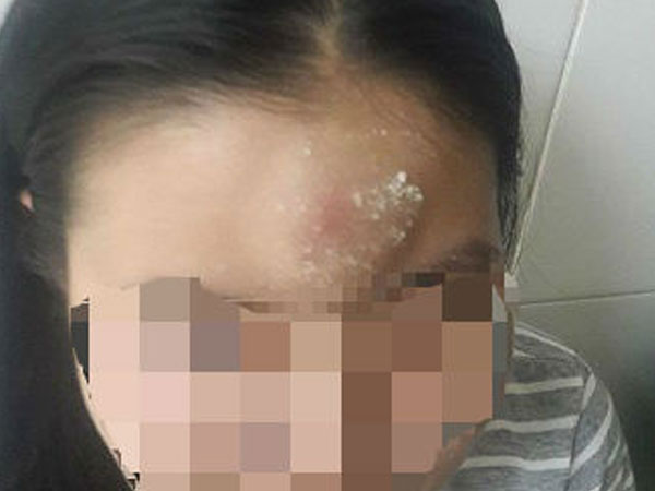 Nữ công nhân bị côn đồ vào tận nhà trọ hành hung