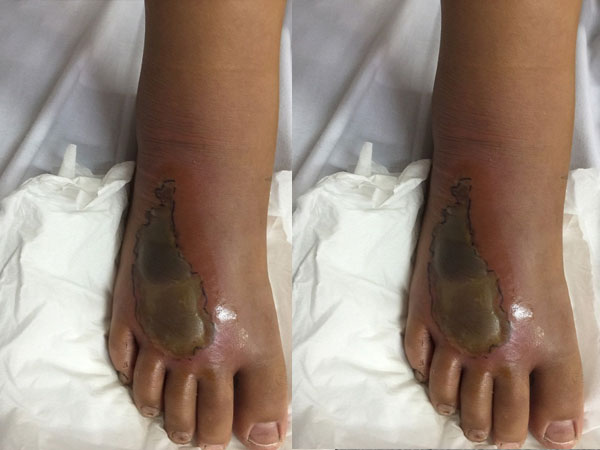Đang chải tóc, bé gái bị rắn độc bò vào nhà cắn