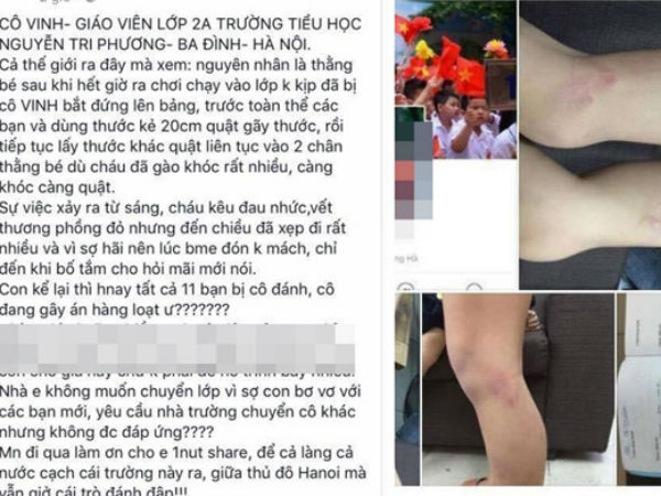 Cô giáo trường Nguyễn Tri Phương đánh học sinh lớp 2 bầm tím