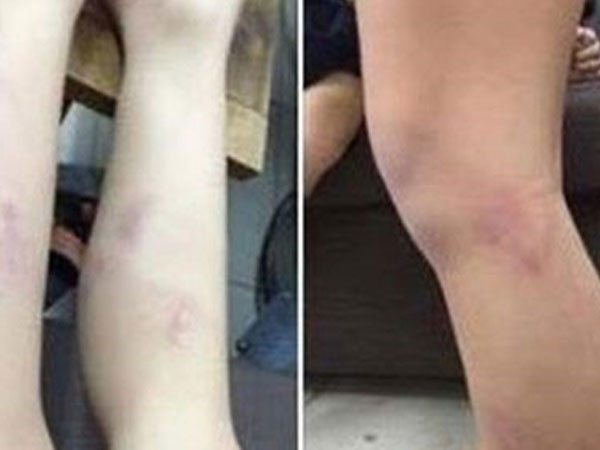 Hà Nội: Tạm đình chỉ cô giáo đánh học sinh do vào lớp chậm