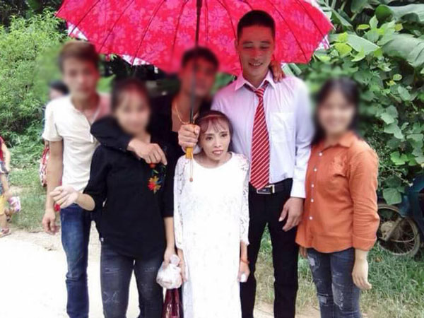 Đám cưới của chú rể Lạng Sơn và cô dâu thấp còi suy dinh dưỡng "gây bão" MXH