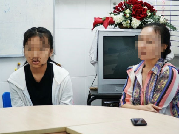 Choáng váng trong ngày hành kinh, bé gái 11 tuổi ngã vào kính trường học, khuôn mặt bị thương nặng nề