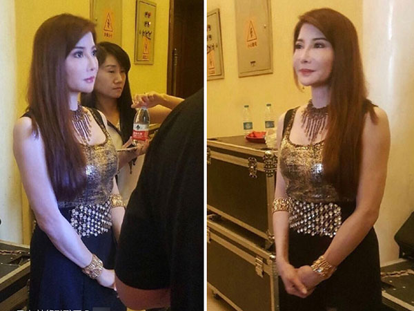 Sao "Bản lĩnh Kỷ Hiểu Lam" cằm nhọn, mũi xộc xệch vì "dao kéo"