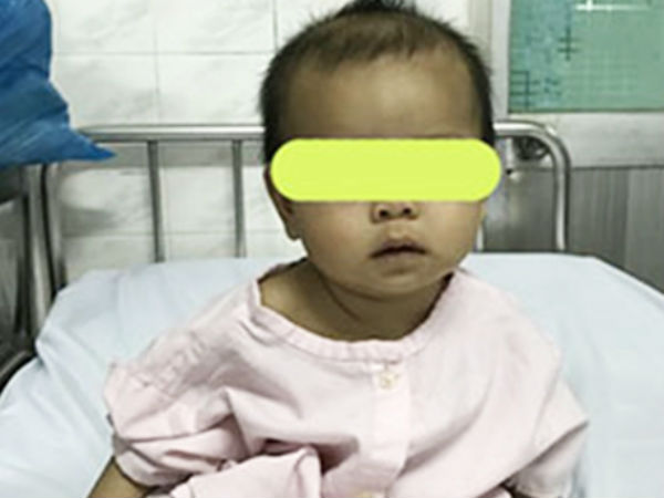 Phụ huynh cẩn trọng: Giật hoa tai của mẹ nuốt vào bụng, bé gái 7 tháng tuổi bị rách thực quản