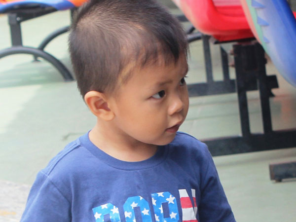 Bé trai bị đâm xuyên não kháu khỉnh tuổi lên hai