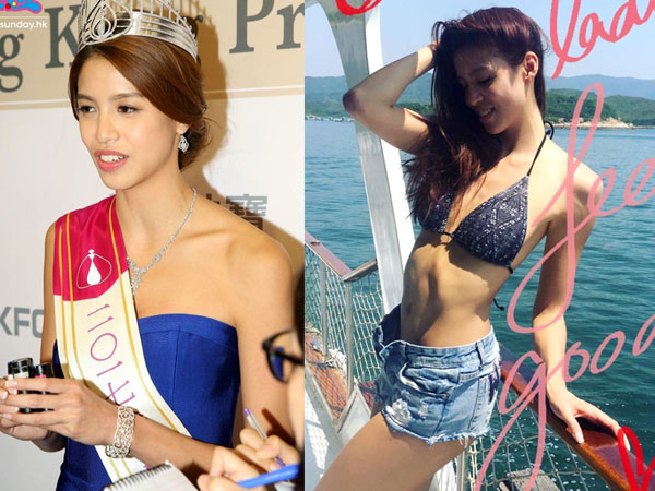 Bị chê răng vổ, tân hoa hậu Hong Kong vẫn tự tin khoe nhan sắc