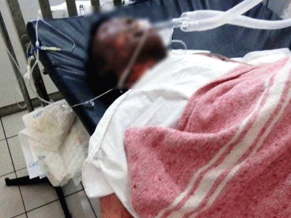 Gia đình trình báo công an việc con trai bị bỏng bất thường trong đêm