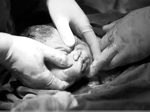 Khi đau đẻ ai cũng đòi mổ nhưng mẹ có biết một ca sinh mổ đau đớn thế nào không?