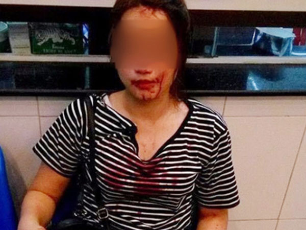 Công an TP Vinh: Sĩ quan công an có mặt nhưng không đánh cô gái