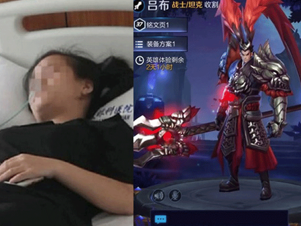 Chơi game cả ngày trên smartphone, cô gái trẻ bị mù một mắt