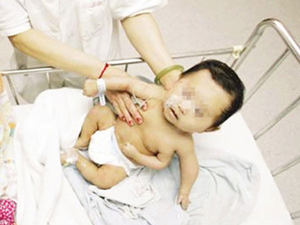 Xót xa mẹ hiếm muộn chờ đợi bao năm cuối cùng con sinh ra lại dị tật 3 tay