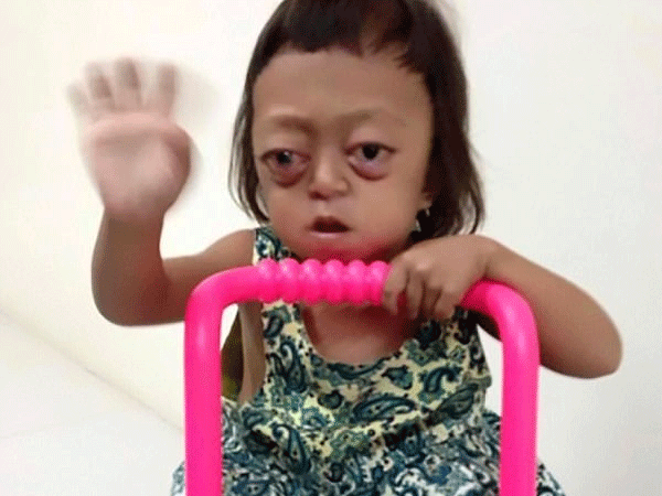 Bé gái bị bệnh không thể ngủ, bị mẹ bán cho "cái bang", ngày ngày chịu đòn để xin tiền