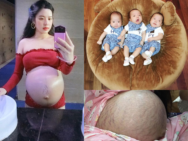 Mẹ 9x kể về hành trình mang thai ba: Quyết định giữ lại cả ba con dù bác sĩ nào cũng khuyên bỏ bớt