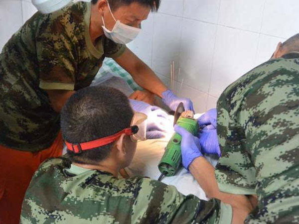 Giải cứu người đàn ông Trung Quốc bị kẹt “của quý” trong cờ-lê