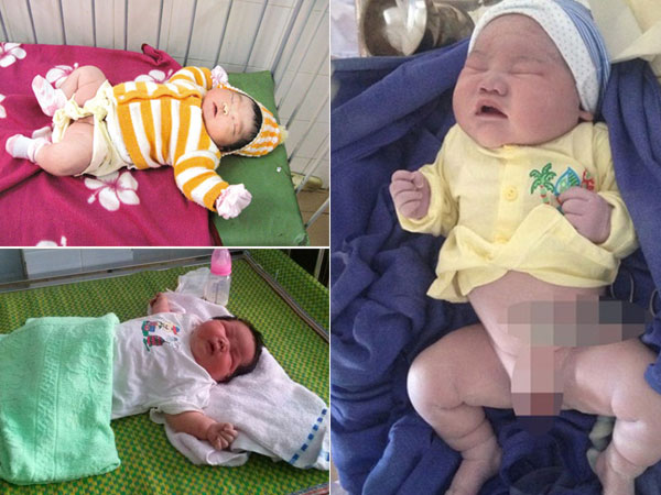 Kinh ngạc trước những em bé vừa chào đời đã có cân nặng “khủng” nhất Việt Nam