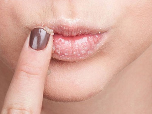 Bỏ túi 3 cách dưỡng môi khô nứt trở nên mềm mịn, căng mướt khi trời chuyển mùa hanh khô