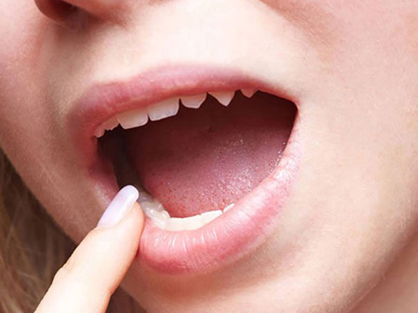 Những lầm tưởng “chết người” về bệnh sùi mào gà