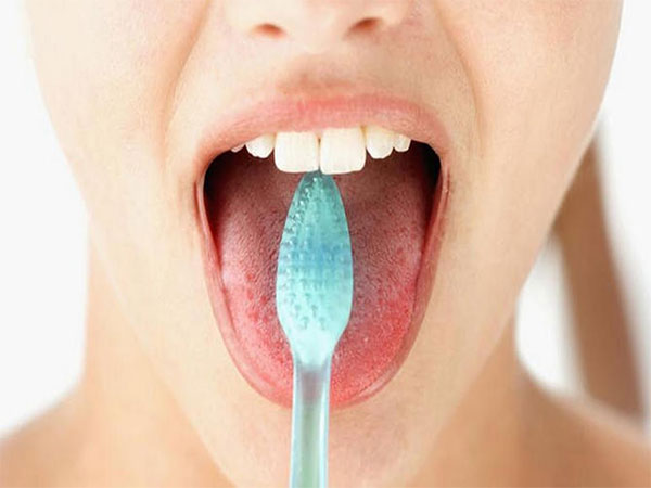 Chứng lưỡi lông đen - Những điều cần biết