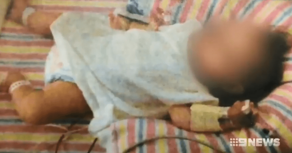 Kết án đôi vợ chồng vì nuôi con theo chế độ thuần chay: 20 tháng tuổi chỉ nặng 4,9kg, suy dinh dưỡng trầm trọng