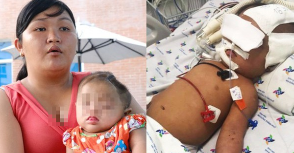 Mẹ của bé gái 8 tháng tuổi nghi bị xuất huyết não ngay ngày đầu tiên gửi nhà trẻ: Cô giáo nói bé tự bị còn camera thì hỏng?
