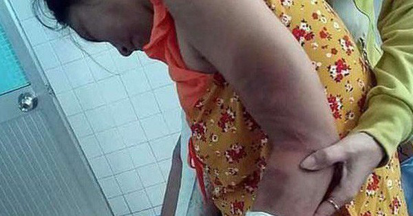 Bắt 'gã chồng hờ' hành hạ dã man thai phụ ở Bình Thuận
