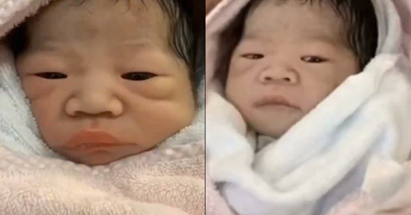 Sinh ra xấu xí bị nhiều người quở, bé gái sau vài tháng lớn lên ngoại hình 'lột xác' khiến dân mạng ngỡ ngàng