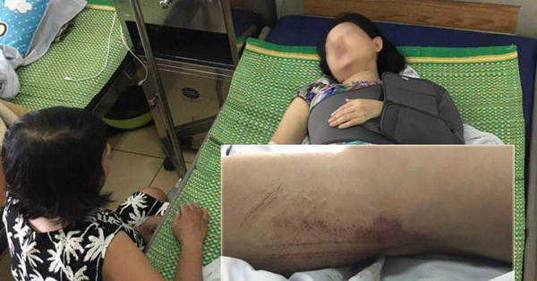 Hà Nội: Nghi án gã đàn ông lái ô tô đâm vợ cũ và con trai phải nhập viện cấp cứu vì tràn dịch màng phổi
